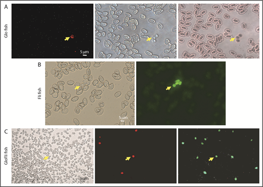Figure 2. Characterization of Glo fish and GloFli fish. (A) Identification of fluorescent thrombocytes in Glo fish. From left to right are images of blood cells in a smear under red fluorescence, cells under bright field, and hematoxylin and eosin–stained cells obtained from Glo fish. Arrows show RFP+ thrombocytes. (B) Identification of GFP+ thrombocytes in Fli fish. From left to right are images of blood cells in a smear from Fli fish under bright field and green fluorescence. Arrows show GFP+ thrombocytes. (C) Identification of DP and DN thrombocytes in GloFli fish. From left to right are images of a blood smear from GloFli fish showing DP and DN thrombocytes, under bright field, red fluorescence, and green fluorescence. Arrows show DP (GFP+/RFP+) and DN thrombocytes (GFP+/RFP−).
