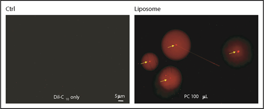 Figure 5. DiI labeling of liposomes. Fluorescence images of liposomes prepared with PC (right panel). Arrows show individual DiI-labeled liposomes. Note the halo surrounding each liposome. DiI in buffer alone as a control (Ctrl) without liposomes.