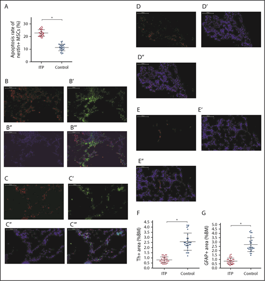 Figure 4. Increased apoptosis rate of BM nestin+ MSCs and reduced sympathetic innervation of BM nestin+ MSCs in ITP patients. (A) Apoptosis rate of nestin+ MSCs analyzed by FACS in the ITP group (n = 30) and control group (n = 28). (B-B′′′) Representative images of BM biopsy tissues immunofluorescently stained with anti-nestin (red), anti-tyrosine hydroxylase (green), and DAPI (blue); merged image indicates the distribution and quantity of nestin+ MSCs and SNs in the control group (scale bar, 100 μm). (C-C′′′) Representative images of BM biopsy tissue immunofluorescently stained with anti-nestin (red), anti-tyrosine hydroxylase (green), and DAPI (blue); merged image shows the distribution and quantity of nestin+ MSCs and SNs in the ITP group (scale bars, 100 μm). (D-D″) Representative images of the BM biopsy tissue from the control group stained with anti-GFAP (red) and DAPI (blue) showing the distribution and quantity of Schwann cells (scale bars, 100 μm). (E-E″) Representative images of BM biopsy tissue from the ITP group stained with anti-GFAP (red) and DAPI (blue) showing the distribution and quantity of Schwann cells (scale bars, 100 μm). (F) Quantification of tyrosine hydroxylase+ (Th+) fibers in the BM from controls (n = 28) and ITP patients (n = 30). (G) Quantification of GFAP+ cells in the BM from controls (n = 28) and ITP patients (n = 30). Data are pooled from 10 independent experiments with 4 to 8 samples per experiment (A,F-G). Data are shown as mean ± SD. Each point represents the mean adjusted value of 3 replicates for each individual patient. P values were calculated using the Mann-Whitney U test. *P < .001.