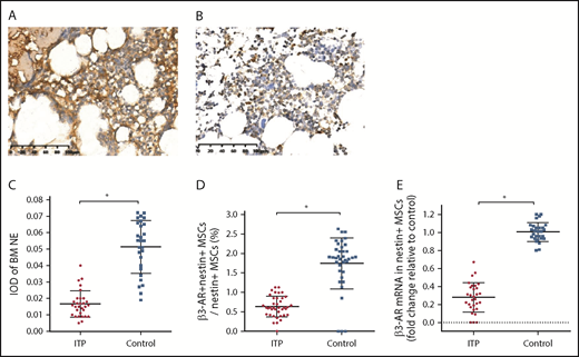 Figure 5. Reduced sympathetic innervation of BM nestin+ MSCs in ITP patients. (A) Representative pictures of BM biopsy tissue from the control group immunohistochemically stained with an anti-NE antibody and hematoxylin and eosin. Scale bar, 100 μm. (B) Representative pictures of BM biopsy tissue from the ITP group immunohistochemically stained with an anti-NE antibody and hematoxylin and eosin. Scale bar, 100 μm. (C) Integral optical densities (IODs) of BM NE staining in the ITP group (n = 30) and control group (n = 28). (D) Percentage of β3-AR+ nestin+ MSCs in nestin+ MSCs analyzed by FACS in the ITP group (n = 30) and control group (n = 28). (E) β3-AR mRNA level in nestin+ MSCs in the ITP group (n = 30) and control group (n = 28). Data are pooled from 10 independent experiments with 4 to 8 samples per experiment (C-E). Data are shown as mean ± SD. Each point represents the mean adjusted value of 3 replicates for each individual patient. P values were calculated using the Mann-Whitney U test. *P < .001.