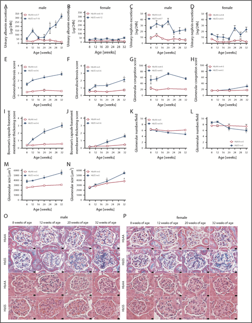 Figure 2. Measures of glomerular injury in male and female HbSS and HbAA mice. Trajectory of urinary albumin excretion in male (A) and female (B) HbAA and HbSS mice. Trajectory of urinary nephrin excretion in male (C) and female (D) HbAA and HbSS mice. Quantification of glomerulosclerosis represented as sclerosis index score in male (E) and female (F) HbAA and HbSS mice. Quantification of glomerular vascular congestion represented as the sum of the glomerular congestion index score in male (G) and female (H) HbAA and HbSS mice. Quantification of the Bowman's capsule basement membrane thickening score in male (I) and female (J) HbAA and HbSS mice. Number of glomeruli per field in male (K) and female (L) HbAA and HbSS mice. Glomerular size represented as mean area of glomeruli from male (M) and female (N) HbAA and HbSS mice. (O) Representative Masson trichrome– and hematoxylin and eosin–stained sections of glomeruli from male HbAA and HbSS mice. Original magnification ×40; scale bar = 50 μm. (P) Representative Masson trichrome– and hematoxylin and eosin—stained sections of glomeruli from female HbAA and HbSS mice. Original magnification ×40; scale bars = 50 μm. Data are mean ± SEM; *P < .05 vs 8-week HbSS mice. Analysis by 1-way ANOVA with repeated measurements with Tukey post hoc analysis. (A) Genotype and age, P < .0001. (B) Genotype, P < .0001; age, P = .9348. (C) Genotype, P < .0001; age, P = .0202. (D) Genotype, P < .0001; age, P = .0279, or 2-way ANOVA with Tukey post hoc test. (E) Interaction, genotype, and age, P < .0001. (F) Interaction, P = .0039; genotype and age, P < .0001. (G) Interaction, P = .3446; genotype, P < .0001; age, P = .2662. (H) Interaction, P = .0003; genotype, P = .0002; age, P < .0001. (I-) Interaction, genotype, and age, P < .0001. (K) Interaction, P = .0571; genotype, P = .0050; age, P = .0038. (L) Interaction, P = .0032; genotype, P = .9450; age, P = .0009. (M) Interaction, P = .0118; genotype and age, P < .0001. (N) Interaction, P = .0005; genotype, P = .0006; age, P = .0001.