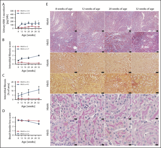Figure 5. Measures of renal tubular injury progression in female HbSS mice compared with genetic controls (HbAA). (A) Trajectory of KIM-1 in female HbAA and HbSS mice. (B) Quantification of interstitial fibrosis index score in female HbAA and HbSS mice. (C) Quantification of interstitial fibrosis in female HbAA and HbSS mice. (D) Quantification of brush border loss index score in male HbAA and HbSS mice. (E) Representative Masson trichrome–, Picro Sirius Red–, and periodic-acid Schiff–hematoxylin-stained sections of renal cortex and medulla from female HbAA and HbSS mice. Original magnification ×10 (scale bars = 100 μm) for Masson trichrome staining and ×40 (scale bars = 50 μm) for Picro Sirius Red and periodic-acid Schiff–hematoxylin stainings. Data are mean ± SEM; *P < .05 vs 8-week HbSS mice. Analysis by 1-way ANOVA with repeated measurements with Tukey post hoc analysis (A) Genotype, P < .0001; age, P = .0049, or 2-way ANOVA with the Tukey post hoc test. (B) Interaction, P = .0140; genotype, P < .0001; age, P = .2854. (C) Interaction, P = .3947; genotype, P = .0004; age, P = .4610. (D) Interaction, P = .0008; genotype, P < .0001; age, P = .0011.