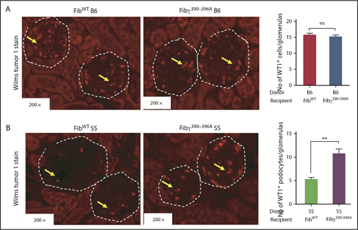 Figure 7. Immunofluorescence staining reveals reduced expression of podocyte marker, WT1 in FibWT SS compared with the Fibγ390-396A SS mice. Fully chimeric similar number of male and female mice were followed for 1 year posttransplant and kidney samples were fixed in formalin after the mice were euthanized, and stained with anti-WT1 antibody. The number of WT1+ podocytes were counted from 20 glomeruli of each kidney section and average number of WT1+ podocytes per glomerulus were calculated. (A) Kidney sections showing similar level of WT1 expression (inside the white dotted circle) in podocytes of glomeruli from FibWT B6 (left panel, n = 6) and Fibγ390-396A B6 (right panel, n = 6) mice. (B) WT1 expression (inside the white dotted circle) is depleted in podocytes of glomeruli of FibWT SS (n = 6) mice compared with the Fibγ390-396A SS (n = 6) mice. The bars in the graph indicate the mean ± SEM. Statistical analyses were done by Mann-Whitney U test and statistical significance are indicated as **P ≤ .01.