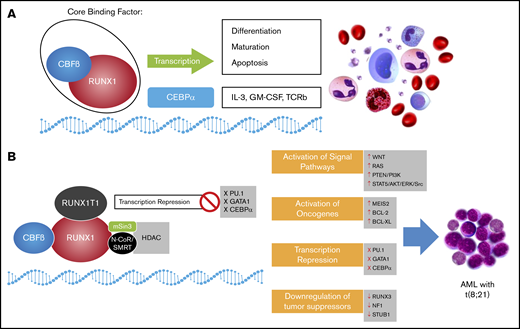 A schematic representation of the role of normal core binding factor and RUNX1-RUNX1T1 fusion protein in hematopoiesis and leukemogenesis, respectively. (A) Core binding factor (CBF) and its role in transcription: The CBF comprises 2 subunits (α and β) that are involved in transcription of genes involved in hematopoiesis. (B) The RUNX1-RUNX1T1 rearrangement leads to recruitment of ETO (encoded by RUNX1T1) that recruits transcriptional repressors, including N-Cor/SMRT and HDAC, that inhibit transcription of hematopoietic genes. GM-CSF, granulocyte-macrophage colony-stimulating factor; IL-3, interleukin-3; TCRb, T-cell receptor beta.