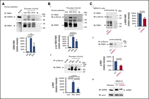 GRK6 forms a complex with PAR1 in activated platelets. (A) Lysates were prepared from resting or thrombin (1 U/mL) activated human platelets. Proteins were precipitated with an anti-PAR1 (ATAP-2) antibody or nonimmune immunoglobulin (Ig) and then probed for GRK6 before reprobing with an anti-PAR1 antibody (N = 5). Note that a marker lane was excised as indicated by the vertical line. (B) Lysates from human platelets incubated with thrombin (1 U/mL) were precipitated with (i) anti-PAR1 (ATAP-2) antibody, then probed with antiphosphoserine antibody before reprobing with an anti-PAR1 antibody, and (ii) antiphosphoserine antibody blot. (Bi) The graph summarizes 6 studies (mean ± SEM). (Bii) The graph summarizes 5 studies (mean ± SEM). (C) Lysates from WT or GRK6−/− MEG-01 were precipitated with anti-PAR1 antibody or nonimmune Ig and then probed with an antiphosphoserine antibody before reprobing with anti-PAR1 antibodies. The graph summarizes 3 studies (mean ± SEM) (Ci). (Cii) Lysates from WT or GRK6−/− MEG-01 were precipitated with antiphosphoserine antibody or nonimmune Ig. The graph summarizes 3 studies (mean ± SEM). (Ciii) Western blot confirmed the loss of GRK6 expression in GRK6−/− clones .