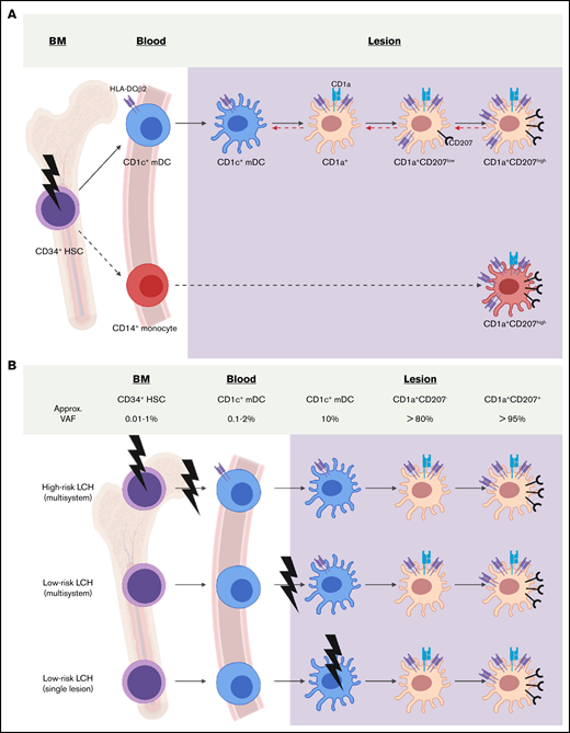 Models of LCH DC differentiation. (A) Previous studies support a model of LCH ontogeny where activating MAPK pathway gene mutation (bolt) in hematopoietic stem and precursor cells (gray) drive LCH lesion formation.3,17,47 This study adds to previous reports by demonstrating HLA-DQB2 (purple surface icon) expression on blood CD1c+ mDCs with BRAFV600E+ in patients with high-risk LCH. Within LCH lesions, the presence of BRAFV600E and HLADQB2 in CD1c+ mDCs, CD1a+CD207− cells, CD1a+CD207low cells, and CD1a+CD207high cells is consistent with differentiation of the CD1c+ mDC precursor from blood into lesion DCs. A logical pathway (solid black arrow) would lead to acquisition of CD1a, then CD207 expression; however, it is also possible that these populations may exist in equilibrium (dashed red arrow) at different stages of terminal differentiation based on environmental cues. Although data from this study support origin of LCH CD1a+CD207+ DCs from blood CD1c+ mDCs, it remains possible that some LCH DCs may arise from blood CD14+ monocytes, though lack of BRAFV600E+CD14+ cells in lesions would require these cells to rapidly differentiate (dashed black arrow) or represent a minor fraction of LCH lesion cells below the limits of detection. (B) This schema shows the Misguided Myeloid Differentiation Model for LCH ontogeny for different risk groups, augmented with data from this study.1 According to this model, the stage of differentiation in which myeloid cell acquires BRAFV600E mutation (or alternative activating MAPK gene mutations) determines the extent of LCH (high- or low-risk LCH). High-risk multisystem LCH arises from activating the MAPK gene mutation of hematopoietic stem/progenitor cells from bone marrow (BM); the low-risk multisystem LCH arises from somatic mutation of committed DC precursor cells in blood; and low-risk single system LCH arises from somatic mutation of more differentiated DC precursors from blood. Although the stage of differentiation in which myeloid cells acquire mutation defines LCH clinical manifestation, data from this study are consistent with blood-derived CD1c+ mDCs migrating to lesion sites and differentiating into pathologic CD1a+CD207+ LCH cells. VAF, variant allele frequency.