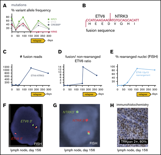 Molecular pathology results. (A) Targeted next-generation sequencing of DNA from bone marrow aspirates with allelic frequency of pathogenic mutations. (B) Sequence of ETV6-NTRK3 transcript revealed with the fusion assay; for more detailed information, see supplemental Figure 1. (C) Number of unique ETV6-NTRK3 fusion reads in bone marrow aspirates (days 1, 32, 59, 295) and lymph node (day 156). (D) Ratio of fusion transcripts (ETV6 exon 4-NTRK3 exon 15) over wild-type transcript (ETV6 exon 4-ETV6 exon 5) from bone marrow aspirates (days 1, 32, 150, 266) and lymph node (day 156). (E) FISH of bone marrow aspirates (day 1, 32, 59, 80, 295) and lymph node (day 156). (F) FISH from lymph node showing break apart of 5′ (red) and 3′ (green) ETV6 probes revealing rearrangement as split-apart red and green signals as well the normal locus (unseparated red-green pair with yellow overlap). Magnification ×100. (G) FISH from lymph node showing break apart of 5′ (red) and 3′ (green) probes recognizing regions upstream and downstream of NTRK3, respectively; rearrangement resulting in split-apart red and green signals as well the normal locus (unseparated pair with yellow overlap). Magnification ×100. (H) Immunohistochemical stain revealing aberrant expression of TRK in lymph node. Magnification ×40. (A-H) Days refer to time from diagnosis.