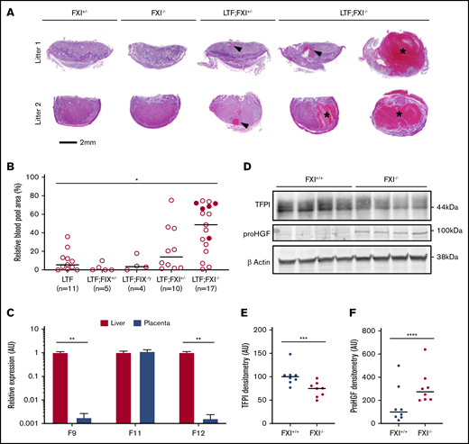 Analysis of the contribution of FIX and FXI to placental blood pooling under conditions of low TF. (A) Representative images of placentas from 2 dams from breeding 3 (top row) and 4 (bottom row), each showing a large blood pool in a low-TF;FXI−/− placenta. Genotypes have been abbreviated to FXI+/− (mTF+/−;hTF+/(+/−);FXI+/−), FXI−/− (mTF+/+;hTF+/(+/−);FXI−/−), low TF;FXI+/− (mTF−/−;hTF+/(+/−);FXI+/−), and low TF;FXI−/− (mTF−/−;hTF+/(+/−);FXI−/−). Blood pools are indicated by arrowheads or asterisks in placentas of E14.5 sections stained with hematoxylin and eosin. (B) The percentage of placental area occupied by maternal blood pools in placentas of different genotypes was quantified at E13.5-E15.5 (n = 4-17 per group). Filled circles indicate ruptured placentas. A significant increase in the percentage area occupied by blood pools was observed in low-TF;FXI−/− placentas compared with low-TF;FXI+/+ placentas. *P < .01, Kruskal-Wallis with post hoc Dunn’s tests; low TF;FIX+/y;FXI+/+ (LTF) vs low TF;FXI−/−. Data represented as individual values with median. (C) F9, F11, and F12 gene expression in the placenta at E14.5 was assessed by quantitative polymerase chain reaction and expressed relative to expression of these genes in the liver. Data are the mean ± SD. **P < .0001 unpaired Student t test (liver vs placenta). (D) Representative western blots of TFPI, pro-HGF, and β-actin in tissue lysates from FXI+/+ and FXI−/− placentas. Densitometric analysis of TFPI (E) and pro-HGF (F) in FXI−/− placentas and FXI+/+ controls (n = 8 per group) normalized against β actin expression. Data are presented as individual values with the median. ***P < .01; ****P < .05, Mann-Whitney U test.