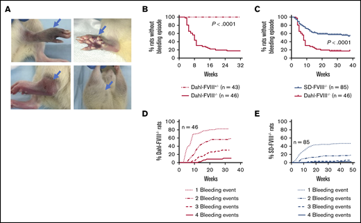 Severe spontaneous bleeding occurs in Dahl-FVIII−/−rats. Affected animals were closely monitored, and bleeding episodes were recorded. (A) Representative images of spontaneous bleeding in our inbred Dahl-FVIII−/− rats. (B) Spontaneous bleeding events in homozygous (FVIII−/−) and heterozygous (FVIII+/−) Dahl rats by 32 weeks of age. (C) Comparison of the occurrence of spontaneous bleeding episodes in Dahl-FVIII−/− (inbred) to SD-FVIII−/− (outbred) rats housed in our facility. SD-FVIII−/− rats were developed by Nielsen et al19 using a zinc-finger nuclease strategy resulting in a 13 bp deletion in exon 16 of the F8 gene. (D) Percentage of Dahl-FVIII−/− rats that experienced bleeding events by 32 weeks of age. (E) Percentage of SD-FVIII−/− rats that experienced events by 32 weeks of age.