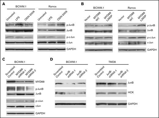 The regulation of JunB by TLR/MYD88 signaling and the impact of JunB on HCK transcription. The phosphorylation of JunB (Ser79) and c-Jun (Ser63) was assessed following TLR4 (by LPS-EB) and TLR9 (by ODN-2006) stimulation (A) as well as the lentiviral cells (C). HCK overexpression of MYD88 L265P mutant vs MYD88 WT (B) in both MYD88-mutated BCWM.1 cells and MYD88 wild-type Ramos cells. The phosphorylation of JunB (Ser79) and c-Jun (Ser63) was determined following MYD88 knockdown in MYD88-mutated BCWM.1 protein levels detected following lentiviral mediated knockdown of JunB in MYD88-mutated BCWM.1 and TMD-8 cells using 2 distinct shRNAs and compared with scrambled control vector (D). Protein levels of MYD88, JunB, c-Jun, and GADPH served as protein expression, knockdown efficiency, and loading controls.