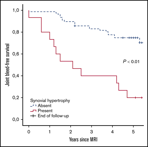 Joint bleed-free survival after MRI assessment for joints with and without synovial hypertrophy. The absolute risk of any 5-year bleeding was 80% for joints with synovial hypertrophy and 27% for joints without synovial hypertrophy.