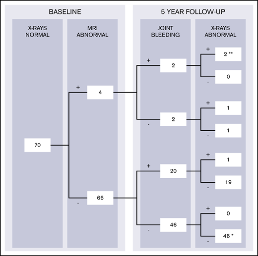 Development of radiographic changes in apparently normal joints at baseline with complete 5-year bleeding and follow-up radiographs (n = 70). The data were stratified according to the presence of MRI findings and report joint bleeding during 5-year follow-up (+, present; -, absent). Complete case analyses for patients with normal radiographs at baseline assessment and available data on 5-year bleeding and follow-up radiographs. Joints with baseline MRI findings (excluding joint effusion) had the highest chance of progression of arthropathy: 3 (75%) of 4 joints exhibited radiographic changes after 5 years. Joints without MRI findings exhibited radiographic changes in 1 (2%) of 66 joints only. Two joints with MRI findings at baseline developed clinical synovitis (**) after bleeding and exhibited radiographic changes as well. One other joint developed clinical synovitis (*), although it was normal on baseline MRI, did not experience bleeds, and was normal on follow-up radiographs.