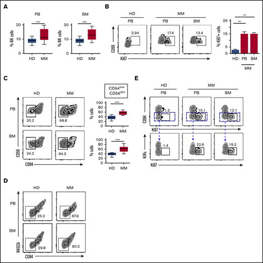 Assessment of NK cell frequency and proliferation in MM patients. (A) PBMCs and BMMCs of MM patients or HDs were analyzed for their frequency of NK cells (gated on total viable CD56+ CD3− lymphocytes). Box and whisker plots represent percentage of NK cells in PB (MM, n = 23; HD, n = 23) and BM (MM, n = 23; HD, n = 3) samples (***P < .001; Student t test). (B) Proliferating NK cells were assessed by Ki67 staining in PBMCs and BMMCs derived from MM patients and in PBMCs from HDs as control. Representative dot plots show the percentage of Ki67+ cells among total NK cells. Data derived from 23 MM patients are summarized in the right panel and compared with PBMN of HDs (n = 20). Bars represent mean values ± SEM of Ki67+ NK cells (**P < .01; Student t test). (C) Representative dot plots of NK cells from PB and BM of MM patients and HDs showing the percentage of CD94lowCD56dim NK cells. Box and whisker plots represent the frequency of CD94lowCD56dim NK cells in PB or BM of 23 MM patients compared with HDs (PB, n = 20; BM, n = 3), (***P < .001; Student t test). (D) Representative dot plots of NK cells from PB and BM of MM patients and HDs showing the frequency of CD94lowNKG2A− NK cells. (E) Analysis of proliferative rate of NK cells isolated from PB and BM of MM patients and from PB of HDs based on the expression of main inhibitory receptors. Top: numbers adjacent to gates indicate the frequency of CD94lowCD56dim Ki67+ NK cells. Bottom: Ki67+ cells within the CD94lowCD56dim NK cell population according to KIR (KIR2DL1/DS1 and KIR2DL2/DL3) expression. SEM, standard error of the mean.