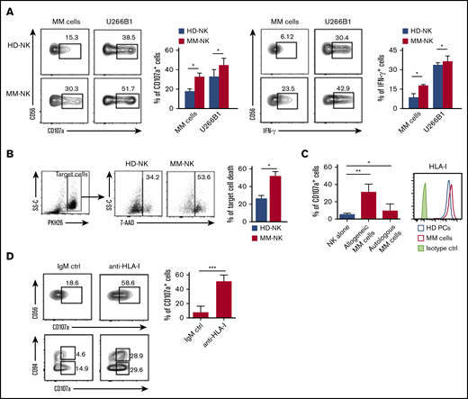 Cytotoxic ability and IFN-γ production of NK cells from MM patients. (A) NK cells isolated from PB of MM patients or HDs were cocultured with allogeneic primary MM cells or U266B1myeloma cell line at an E/T ratio 1:1 for 6 hours. (Left) Degranulation activity was assessed by evaluating the percentage of CD107a+ NK cells. One representative experiment of 8 is shown. Data from all the experiments are summarized in the bars as mean ± SEM of CD107a+ cells. (Right) IFN-γ production by NK cells was analyzed by flow cytometry. One representative experiment of 8 is shown. Results of all experiments performed are summarized in the bars as mean ± SEM of IFN-γ+ cells. (B) NK cells isolated from PB of MM patients or HDs were cocultured with U266B1 at an E/T ratio 1:1 for 3 hours. Killing capability of NK cells was assessed by evaluating target cell death on coculture. U266B1 target cells are gated as PKH26+ events and, following coculture with NK cells, dead cells were identified as positive for the viability dye 7AAD. One representative experiment out of 5 is shown. Results of all experiments performed are summarized in the bars as mean ± SEM of target cell death. (C) Degranulation ability of patient-derived NK cells against autologous or allogeneic MM cells. Bars show data from 10 independent experiments and represent mean ± SEM of CD107a+ cells. MM cells used for the degranulation assay were further analyzed for the expression of total HLA class I (clone W632) by flow cytometry. Histograms show data from a MM representative patient compared with healthy B plasma cells isolated from human tonsil. (D, top) Degranulation ability of patient-derived NK cells was analyzed against autologous MM cells in the presence either of an anti-HLA-I blocking antibody (clone A6-136, IgM) or an isotype-matched irrelevant IgM (IgM ctrl). One representative experiment is shown and numbers in each gate represent the percentage of CD107a+ cells. Data from 6 independent experiments are summarized in the bars and presented as mean ± SEM of CD107a+ NK cells, Student t test. (D, bottom) The same experiment but in relation to CD94 expression on NK cells. *P < .05, **P < .01, ***P < .001; Student t test.