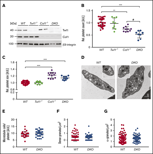 Severe macrothrombocytopenia in MK-specific Twf1/Cof1-deficient mice. (A) Absence of Twf1 and Cof1 was confirmed in platelets derived from WT, Twf1−/−, Cof1−/−, and DKO mice by immunoblotting. Platelet count (B) and size (C) were determined using an automated blood cell analyzer (ScilVet). Values of Twf1−/−, Cof1−/−, and DKO mice were normalized to the respective WT control. Values for all controls are shown. Mean ± SD (n = 9). One-way ANOVA with Sidak correction for multiple comparisons. #P < .05; **P < .01; ***P < .001. (D) Transmission electron microscopic images of WT and DKO platelets. Scale bars, 0.5 µm. Insets display microtubule coils. Scale bars, 0.2 µm. Analysis of microtubule (E), dense granule (F), and α-granule (G) numbers in WT and DKO platelets. Values are mean ± SD (n = 3).