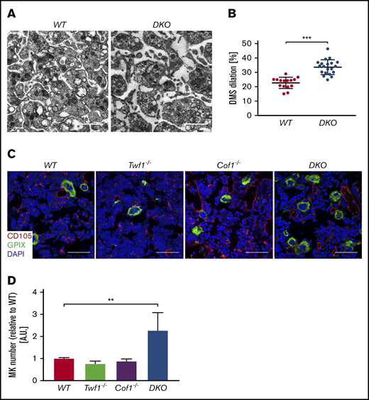 Altered MK morphology and increased number of bone marrow MKs in DKO mice. (A) BM MKs from WT and DKO mice were analyzed by transmission electron microscopy. Scale bars, 1 µm. (B) DMS dilation as a measure of altered DMS maturation was quantified using ImageJ software (National Institutes of Health). Values are mean ± SD (n = 3). Unpaired, 2-tailed Student t test. ***P < .001. (C) Confocal fluorescence microscopic images of femora cryosections of WT, Twf1−/−, Cof1−/−, and DKO mice (Leica TCS SP5). Scale bars, 50 µm. MKs, proplatelets, and platelets are shown by GPIX staining in green. CD105 staining (red) labels vessels. Nuclei were counterstained using DAPI (blue). (D) Quantification of BM MKs in whole femora cryosections. Values of Twf1−/−, Cof1−/−, and DKO mice were normalized to the respective WT control. Values are mean ± SD (n = 3). One-way ANOVA with Sidak correction for multiple comparisons. **P < .01.