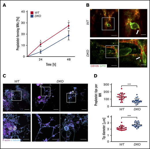 Impaired proplatelet formation of DKO MKs in vitro and in vivo. (A) PPF of BM MKs after lineage depletion and culturing in rHirudin- and TPO-conditioned medium. Proplatelet-forming MKs were counted after enrichment of MKs using a body surface area density gradient. Average of 5 analyzed visual fields per MK culture is shown. Values are mean ± SD (n = 3). Unpaired, 2-tailed Student t test. *P < .05. (B) Intravital 2-photon microscopy of BM MKs in the skull. Blood vessels were visualized with body surface area-FITC and CD105 Alexa F488. MKs were stained with an anti-GPIX antibody derivative conjugated to Alexa F546. Insets and arrows point to proplatelet shafts reaching into sinusoidal vessels. Images are representative of at least n = 5. Scale bars, 50 µm; insets, 20 µm. BM MKs were centrifuged onto glass slides. (C) Proplatelets were visualized using an α-tubulin antibody and phalloidin and analyzed by confocal microscopy (40× objective, Leica TCS SP8) using a 40× objective. Scale bars, 20 µm (upper panels) and 50 µm (lower panels). (D) Quantification of platelets tips per MK and platelet tip size of in vitro–matured WT and DKO MKs. Values are mean ± SD (n = 3). Unpaired, 2-tailed Student t test. ***P < .001.