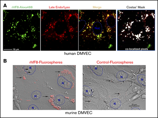Binding and uptake of FVIII by conditioned DMVECs. (A) Confluent hDMVECs were pretreated with 100 nM IFN-γ (48 hours) and 100 nM TNF-α (24 hours) prior to incubation for 12 hours rhfF8–Alexa 488 (10 U/mL; in the presence of 1 U/mL VWF and 150 µg/mL FIB) together with Lysotracker Red (late endosome/lysosome marker; 50 nM). Cells were then rinsed and imaged live. Fluorescence microscopy showed significant rhfF8–Alexa 488 (green) accumulated into perinuclear punctae, which partially colocalized with late endosomes/lysosomes (red) as seen by the yellow signal in the merged image. This was validated by computational image analysis, which also identified substantial areas of rhfF8-488 and Lysotracker Red coincidence, as depicted by white pixels in the Costes mask (right panel) and reflected in an average Pearson correlation coefficient of 0.680 ± 0.033 (r2 > 0.98; Costes P = 100%). Scale bar, 25 μm. (B) As a complementary and more sensitive approach to detect FVIII binding and uptake, rhfF8 was coated onto GMA-8021 (anti-FVIII MAb)-conjugated carboxylate-modified red fluorescent nanoparticles (rhfF8 fluorospheres). The same fluorescent particles were subjected to blocking of the carboxylate modification with 2% BSA to demonstrate the level of nonspecific binding and cellular uptake (Control fluorospheres). Fluorospheres were then incubated together with 150 µg/mL fibrinogen in the presence (not shown) or absence of 1 U/mL VWF for 1.5 hours on IFN-γ– and TNF-α–conditioned mDMVECs. Differential interference contrast (DIC) and confocal fluorescence images were superimposed. Arrowheads indicate patches of putative membrane-bound rhfF8. Arrows indicate putatively internalized perinuclear clusters of rhfF8 that presumably represent endosomes and lysosomes (left panel). The same pattern was observed in the presence of VWF. In the absence of rhfF8 coating, control fluorospheres showed very little EC binding or uptake (right panel, arrows). Scale bar, 20 μm.