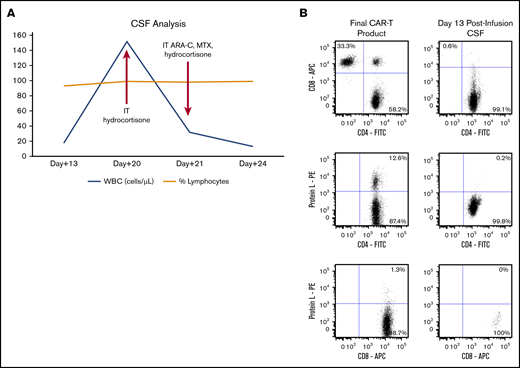 CSF analysis for patient 1. (A) Trends in WBCs in the CSF over time after CAR T-cell infusion and time points of intervention. (B) Flow cytometry plots of final CAR T-cell product and CSF. T cells in the CSF at day 13 postinfusion were predominantly CD4+ non-CAR T cells. Preinfusion final CAR T-cell product phenotype after staining cells with a combination of markers for CD3, CD4, CD8, and protein L (to detect the CAR) and analyzing the stained cells by flow cytometry (left panels). The same panel of markers was used to analyze CSF collected at day 13 postinfusion (right panels). The plots were based on gated CD3+ T cells. ARA-C, cytarabine; MTX, methotrexate.