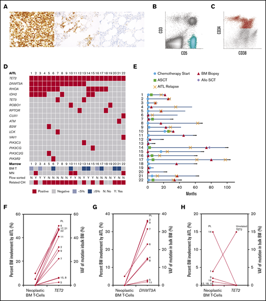 Histologic, flow cytometric, clinical and mutational features of 22 patients with AITL. (A) Photomicrographs of PD-1 immunohistochemical stains from 3 patients (original magnification ×400). An example lymph node biopsy specimen from patient 16 (far left) demonstrates a proliferation of strongly PD-1–positive T cells, consistent with AITL. The middle image depicts a BM biopsy specimen from patient 14 with lymphohistiocytic aggregates containing PD-1–positive T cells, consistent with involvement by AITL. The far right image depicts a BM biopsy specimen from patient 11 that showed small lymphoid aggregates that were negative for PD-1, consistent with a reactive infiltrate, which was confirmed by FC. (B-C) Scatterplots from FC analyses of a BM involved by AITL (patient 17) (B, aqua neoplastic T-cell population) and a BM involved by MDS (patient 2) (C, red CD34+ abnormal myeloid blast population). (D) Mutations detected in the AITL of each patient (each column represents 1 patient and is annotated with the patient’s identification number). The degree of AITL involvement in each patient’s paired BM (BM T), as well as whether a MN was identified, whether FC sorting was performed, and if shared TET2 and/or DNMT3A mutations were detected in the myeloid compartment (related CH), are also indicated in the bottom rows. (E) Swimmer plot indicating the time points at which the sequenced BM biopsy was obtained, chemotherapy was initiated, or autologous or allogeneic stem cell transplant (ASCT or Allo SCT, respectively) was performed, as well as points of AITL relapse for each patient (each row represents 1 patient and is annotated with the patient's identification number). Month 0 indicates the time at which AITL was first diagnosed. Horizontal arrows indicate patients alive at last follow-up. (F-G) Comparison of the level of BM involvement by AITL (neoplastic BM T cells) to the VAFs of the TET2 and DNMT3A mutations detected in the sequenced bulk BMs among patients with shared TET2 (F) and DNMT3A (G) mutations. (H) Patients without shared TET2 mutations. Each line represents one patient and is annotated with the corresponding patient identification number.