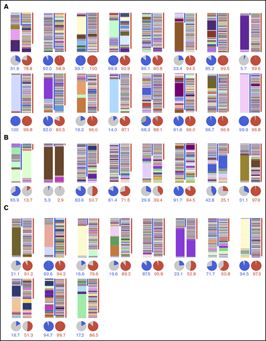 TCRβ repertoire analysis in PBMCs by next generation sequencing. TCRβ repertoire before and after mogamulizumab treatment in patients with (n = 16) (A) or without (n = 8) (B) EM, and before and after chemotherapy without mogamulizumab (n = 11) (C). Bar graphs and pie charts in the left and right panels depict the TCRβ repertoire in PBMCs before and after treatment, respectively, in each patient. Each CDR3 sequence and its frequency is shown by individual color and height, respectively, in the bar graph. The blue and red lines on the right side indicate the CDR3 sequences specific to the samples obtained before and after treatment, respectively. The blue, red, and gray slices in the pie charts indicate the frequency of the CDR3 sequences specific to the samples obtained before and after treatment, as well as those detected at both points, respectively. The percentages of the CDR3 sequences specific to the samples obtained before and after treatment are shown as blue and red numbers, respectively, below the pie charts.