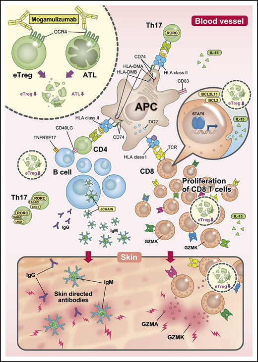 Immunological status in PBMCs from patients with mogamulizumab-induced EM. After treatment with lymphocyte-depleting mogamulizumab, robust homeostatic CD8+ T-cell proliferation occurs, which is driven by the engagement of self-antigens, including skin-related antigens, together with prolonged Treg depletion. This is enhanced by the observed activation of antigen presentation and accompanied by diversification of the TCR repertoire. This proliferation and diversification are primarily the result of newly emergent T-cell clone proliferation at the time of EM development. Subsequently, certain CD8+ T cells migrate to the skin and attack it by releasing GZMK and GZMA. Additionally, Th17 cells play an important role in EM, and B cells are activated and differentiate, leading to the production of autoantibodies that attack the skin. APC, antigen-presenting cell; eTreg, effector regulatory T cells; IgG, immunoglobulin G; IgM, immunoglobulin M.