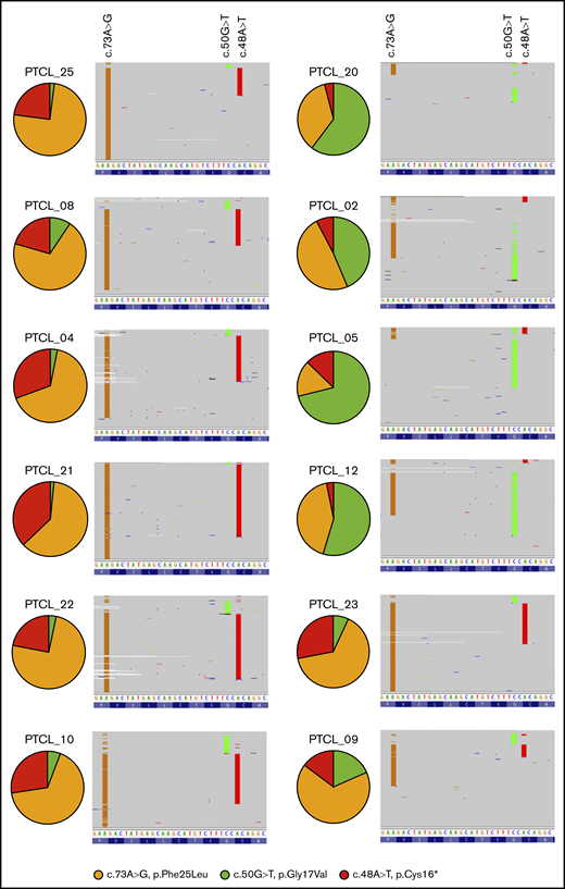 RHOA mutational frequencies and haplotypes vary between individuals. Haplotypes at RHOA exon 2 from each PTCL case in which the baseline plasma sample contained a total RHOA mutational burden (VAF) >10%. The pie chart represents the proportions of each individual exon 2 mutation as a fraction of all reads bearing a RHOA mutation. Panels to the right show down-sampled read pileups (representing ∼10% of all reads) with the position of mutations indicated above and the DNA sequence below.