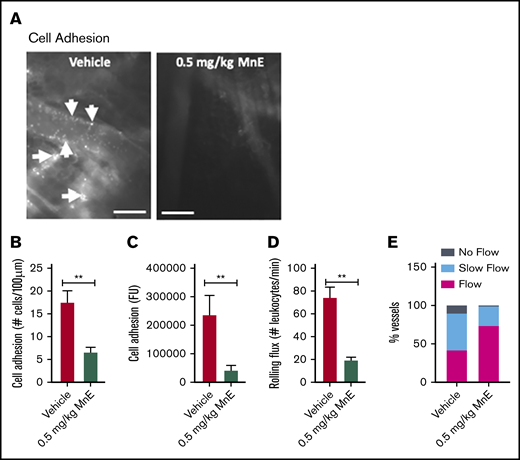 Mn porphyrins reduce cell adhesion and restore blood flow in vivo. (A-E) TS mice were treated subcutaneously with 1 dose of vehicle or 0.5 mg/kg MnE, followed immediately by 500 ng TNF-α; intravital microscopy was then performed per protocol 2. (A) Intravital microscopy was performed on anesthetized treated TS mice. Representative images of postcapillary venules (20× magnification) from treated TS mice are presented. Leukocyte and RBC adhesion and vaso-occlusion are indicated with arrows. Scale bars, 50 μm. (B-D) Video frames showing vessel segments were used to quantify fluorescence-labeled cell (leukocyte and RBC) adhesion (B-C) and leukocyte rolling flux (D) in all venules and arterioles were recorded, and numbers were averaged among groups of animals. Cell adhesion presented as number of adherent cells per 100 μm vessel length (B), and fluorescence unit (FU) (C). Leukocyte rolling flux presented as number of leukocytes per minute (D). TS mice injected simultaneously with 1 dose of 0.5 mg/kg MnE and TNF-α showed sporadic cell adhesion (B-C) and reduced leukocyte rolling (D) as opposed to the vehicle group. (E) Blood flow in vivo. Percentage of vessels with normal, slow, and no blood flow (occluded vessels) are shown. Average vessel diameter was almost identical (∼21 μm) in all treatment groups. Blood stasis in TS mice treated with 0.5 mg/kg MnE was significantly reduced compared with the vehicle group. Error bars show SEM of 6 different experiments for each treatment group. **P < .01 compared with vehicle treatment regardless of the vessel diameter within the ranges specified.