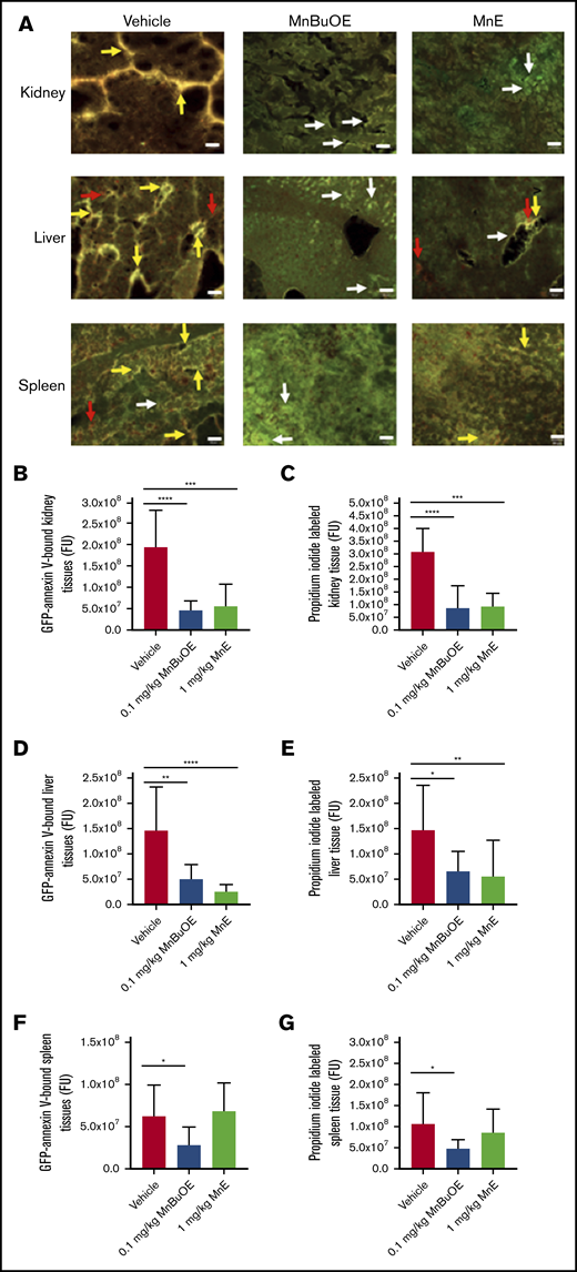 Mn porphyrins improve organ cell apoptosis in TS mice in vivo. (A) Representative dual-labeling studies with GFP-labeled annexin V and PI of tissue organs: kidneys, liver, and spleen isolated from TS mice treated with vehicle, 0.1 mg/kg MnBuOE, and 1 mg/kg MnE. GFP-labeled annexin V–binding (green color), PI-staining (red color), and double-staining (yellow or brown color) regions are indicated with arrows (white, red, and yellow arrows, respectively). Scale bars, 50 μm. (B-G) Separate quantitation of GFP (B,D,F) and PI (C,E,G) staining in each organ: kidneys (B-C), liver (D-E), and spleen (F -G) collected from treated TS mice. Mn porphyrins could indeed alleviate organ damage as reflected by decreased apoptosis compared with the vehicle group. Data are presented as the mean of n = 5 random fields/organ/treatment condition ± SEM (n = 4 animals per treatment condition). *P < .05, **P < .01, ***P < .001, and ****P < .0001 vs vehicle treatment. FU, fluorescence unit.