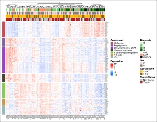 Unsupervised clustering of the cHL, GZL, polymorphic-EBV-L, and PMBCL samples based on the main biological pathways. Pathways were identified by using preranked GSEA of genes ordered by their correlation with PC1 or PC2 scores. The top 10 genes included in the core set of the significant pathways were selected. The pathways were grouped into functional categories including cell cycle (high in PMBCL and group 3), epithelial-mesenchymal transition (EMT)/matrisome/extracellular matrix (ECM), cellular microenvironment (NK cells, T cells/allograft rejection, IFN), and humoral response. Unsupervised clustering of the samples based on expression of these pathway genes revealed a spectrum with PMBCL and group 3 at one extreme, and cHL cases mixed with GZL groups 0, 1, and 2.