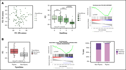 PCA of GZL spectrum samples. (A) The left plot shows group 0, bona fide GZL, and group 3 samples in PC1 vs PC2 space, reflecting 20% and 11% of the variance, respectively. The middle box plot shows the distribution of PC1 scores based on GZL group (each point represents a sample). Group 3 cases have significantly distinct PC1 scores, whereas group 0 do not (pairwise Student t tests). Group 1 and 2 GZL cases (bona fide GZL) also have similar PC1 scores (P = .25). The right plot shows that B-cell receptor (BCR) pathway genes were strongly negatively correlated with PC1 score, suggesting association with group 3 cases. (B) The left box plot shows PC1 scores based on thymic status within this cohort. In preranked GSEA (middle panel), genes negatively correlated with PC1 score were enriched in the class I antigen presentation pathway, suggesting that non-thymic cases may present a stronger MHC-I presentation machinery compared with thymic cases. Validating the GSEA findings, cases with thymic involvement had significantly lower MHC-I expression (assessed via IHC) compared with cases without thymic involvement (97% vs 66% for thymic vs non-thymic, respectively; χ2 test, P = .00066).