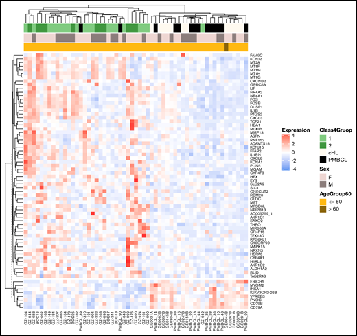 Expression of the bona fide GZL signature genes. Unsupervised clustering of the thymic bona fide GZL (groups 1-2), cHL (EBVneg only), and PMBCL cases shows 2 distinct clusters, with a small number of discordant PMBCL and GZL cases.