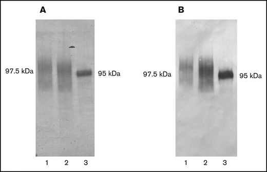 The expression of recombinant TMs. (A) SDS-PAGE of recombinant TMs. Each protein (5 μg) reduced with 2-mercaptoethnol in the presence of SDS was loaded in each lane, and after electrophoresis, the proteins were stained with CBB. Lane 1, rhsTM G412D; lane 2, rhsTM; and lane 3, Recomodulin. (B) Western blotting of recombinant TMs. Each protein (4 μg) reduced with 2-mercaptoethnol in the presence of SDS was loaded in each lane, and after SDS-PAGE the proteins transferred onto the nitrocellulose membrane were detected with antihuman TM polyclonal antibody as described in the text. Lane 1, rhsTM G412D; lane 2, rhsTM; and lane 3, Recomodulin. The molecular weight of recombinant TMs was determined by a comparison with the mobility of commercial marker proteins.