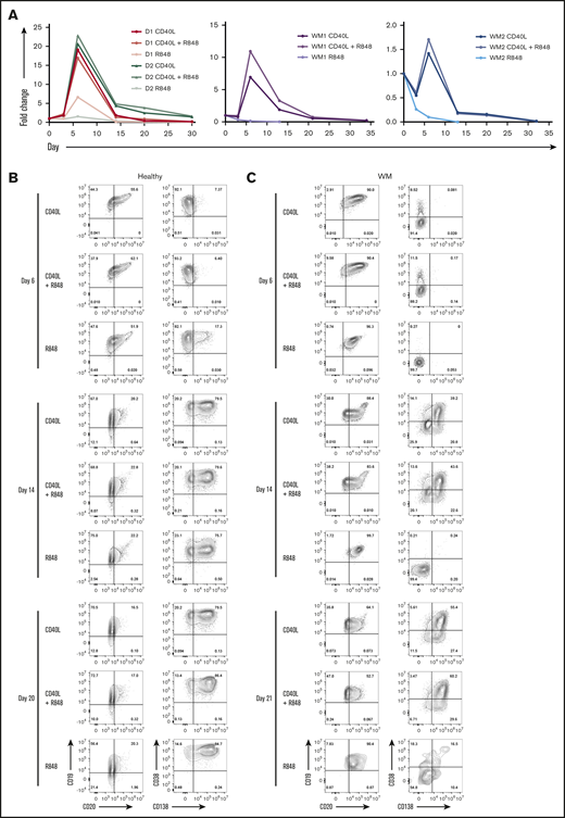 Combinatorial activation of WM B cells by TLR7 agonist, BCR triggering, and T-cell help generates PCs. (A) B cells derived from the peripheral blood of 2 healthy donors (left panel) or 2 WM patients (middle and right panels) were stimulated with CD40L+anti-BCR (CD40L), CD40L+R848+anti-BCR (CD40L+R848), or R848+anti-BCR (R848). The fold change in cell number at each time point was determined by manual counts for day 3 and day 6 and then by flow cytometry thereafter. The cell number at each point was normalized to the number of “input” cells for that specific patient obtained at day 0. The immunophenotype of cells from a representative healthy (B) or WM (C) sample, stimulated as in panel A, was assayed by flow cytometry at each time point. Percentages are displayed for each quadrant.