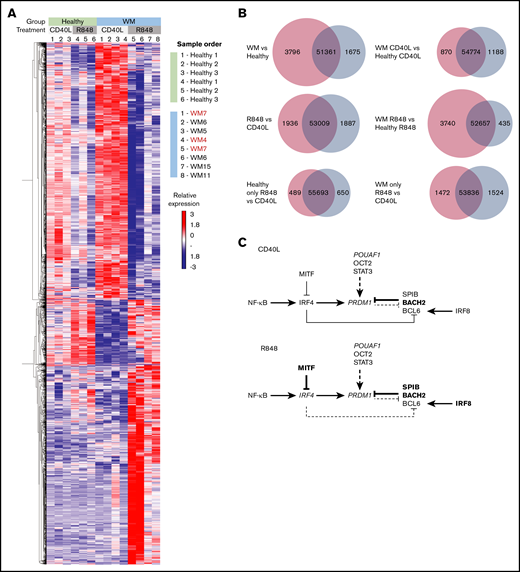 WM cells exhibit a block in the PC gene-expression program. (A) Hierarchically clustered heat map of differentially expressed genes between healthy and WM samples in day-6 in vitro–generated cells from R848 or CD40L conditions. The threshold for significance was a false discovery rate <0.05. WM samples with CXCR4 mutations are indicated in red (WM4 and WM7). (B) Venn diagrams depicting the significantly differentially expressed genes for each stated comparison. The number of upregulated genes is displayed in red, the number of downregulated genes is displayed in blue, and the number of nonsignificant genes is shown in the center. (C) The interaction between key genes involved in PC differentiation is depicted for cells stimulated with CD40L (upper panel) or R848 (lower panel). Genes that are upregulated in WM samples compared with healthy samples are in larger and bold type, whereas those that are downregulated are shown in smaller and italicized type.