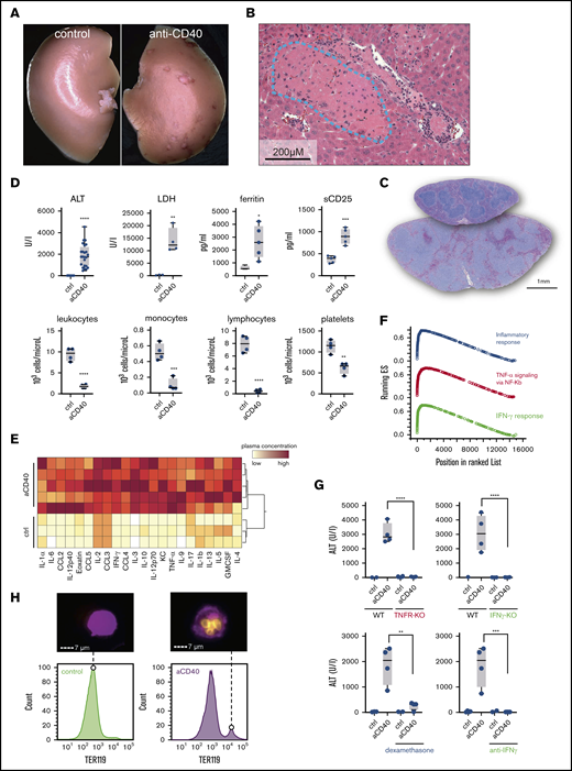 Anti-CD40–treated mice develop clinical and biochemical features of hemophagocytic syndrome. (A) Macroscopic picture of representative liver lobes of a control and anti-CD40–treated mouse at 30 hours after antibody treatment (original magnification ×1.25). Ischemic infarcts were detected in the anti-CD40 antibody-treated wild-type mouse (white spots on the liver lobe). (B) Representative photographs of hematoxylin and eosin (H&E)–stained liver tissue sections from a mouse 30 hours after antibody injection. Ischemic infarcts were detected in the area within the blue dashed line. (C) Representative photographs of H&E-stained spleen tissue sections from saline (upper section of the right panel) or anti-CD40–treated mice (bottom section of the right panel). Mice were euthanized 48 hours after antibody treatment. (D) Plasma concentrations of ALT, LDH, ferritin, sCD25 (top panels), and blood count analysis for total leukocytes, monocytes, lymphocytes, and platelet count (bottom panels) in saline (control) and anti-CD40–treated mice (n ≥ 4). (E) Hierarchical clustering analysis of cytokines and chemokines in saline or anti-CD40–treated mice, 12 hours postinjection. Plasma protein concentrations were measured by Bioplex and are color-coded. Red indicates high concentration; yellow low concentration. Each line identifies an individual saline or anti-CD40–treated animal. (F) Gene-set enrichment analysis enrichment score plots for the top 3 most positively enriched hallmark gene sets for the differentially expressed genes in F4/80+ liver macrophages of anti-CD40 antibody-treated animals vs saline-treated animals. (G) Top panels, Plasma ALT concentrations in saline (n = 2-3) or anti-CD40 antibody-treated wild-type mice, TNFR1/2 knockout mice, and IFN-γ knockout mice (n = 4). Bottom panels, Plasma ALT concentrations in wild-type mice treated with dexamethasone or neutralizing anti-IFN-γ, with or without anti-CD40 antibody (n = 2-4). (H) Left panels, Representative histograms of liver cell suspensions stained for F4/80 (macrophages) and intracellular TER119 (red blood cells) in saline or anti-CD40-treated wild-type mice. The displayed cells were gated from live CD45high leukocytes. Data are representative of 3 independent experiments. Right panels, Corresponding pictures generated by Image Stream X flow cytometer showing intracellular TER119high erythrocytes (yellow) in F4/80high macrophages (magenta). Individual symbols represent 1 mouse; ****P < .0001; ***P < .001; **P < .01; *P < .05 for all panels.