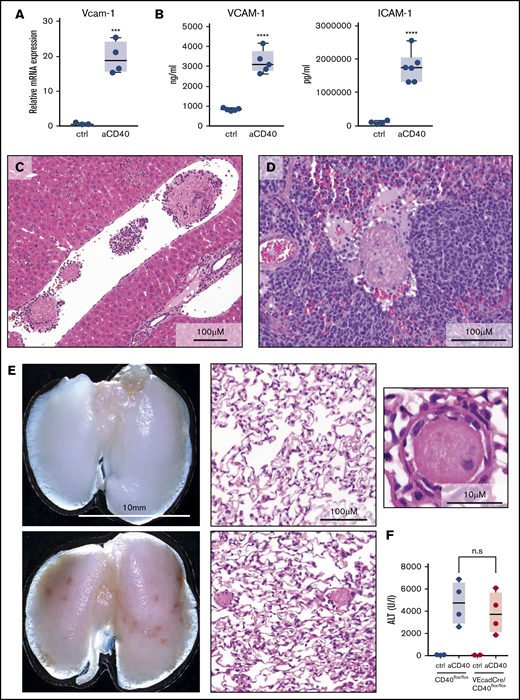 Endothelial cell activation and vaso-occlusion after anti-CD40 injection. Mice were treated with anti-CD40 antibody and euthanized 30 hours postinjection. (A) messenger RNA (mRNA) expression of Vcam-1 measured by real-time polymerase chain reaction (RT-PCR) in fluorescence-activated cell sorting (FACS)-sorted CD45low CD31/CD102high liver endothelial cells of saline (control) (n = 3) and anti-CD40–treated (n = 4) wild-type mice. (B) Left panel, VCAM1 quantification in plasma of saline (n = 5) and anti-CD40–treated (n = 5) mice. Right panel, ICAM1 quantification in plasma of saline (n = 4) and anti-CD40–treated (n = 6) mice. (C) Representative photograph of a H&E-stained liver tissue section from an anti-CD40–treated mouse. (D) Representative photograph of a H&E-stained splenic tissue section from an anti-CD40–treated mouse. (E) Macroscopic image of representative lungs of saline (top left panel) and anti-CD40–treated mice (bottom left panel). Ischemic infarcts can be detected in the anti-CD40–treated mouse lungs (dark spots on the lungs). Representative photographs of H&E-stained lung tissue sections from control (top middle panel) and anti-CD40–treated mice (bottom middle panel). A higher magnification of an intravascular thrombus from the lung section of the anti-CD40-treated mouse is appreciable in the top right panel. (F) Plasma ALT concentrations in CD40flox/flox mice (wild-type) (black dots) or VE-cadCre CD40flox/flox mice (red dots) after saline (n = 2-3) or anti-CD40 antibody treatment (n = 4). Individual symbols represent 1 mouse; ****P < .0001, *** P < .001, not significant (n.s.) P > .05, for all panels.