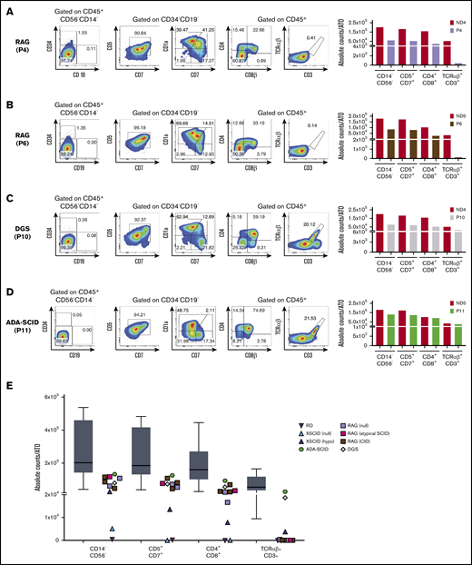 Human T-cell differentiation in patients with late T-cell block or without defects and summary of all T-cell differentiation assays. (A-D) T-cell differentiation assay in patients with RAG mutations, giving rise to a SCID (analyzed at 8 weeks) (A) or CID-G and autoimmunity (CID-G/AI) phenotype (6 weeks) (B), with DGS (8 weeks) (C), and with ADA-SCID (6 weeks) (D). The FACS plots show expression of CD34, CD19, CD7, CD5, CD1a, CD4, CD8β, TCRαβ, and CD3 upon gating on LIVE/DEAD–CD45+CD14–CD56– cells. CD5, CD7, and CD1a plots are obtained upon gating on LIVE/DEAD–CD45+CD14–CD56–CD34– cells. The bar graphs show the absolute cell counts per ATO in the indicated gates in each patient’ sample and in the ND sample (red bars) analyzed in parallel in the T-cell differentiation assay. (E) Summary of the absolute cell counts in the different T-cell subsets analyzed in all the experiments performed. The horizontal bar inside the gray box indicates the median, and the whiskers indicate 5% to 95% confidence intervals for all ND samples analyzed (n = 9). Each symbol represents a patient’s sample.