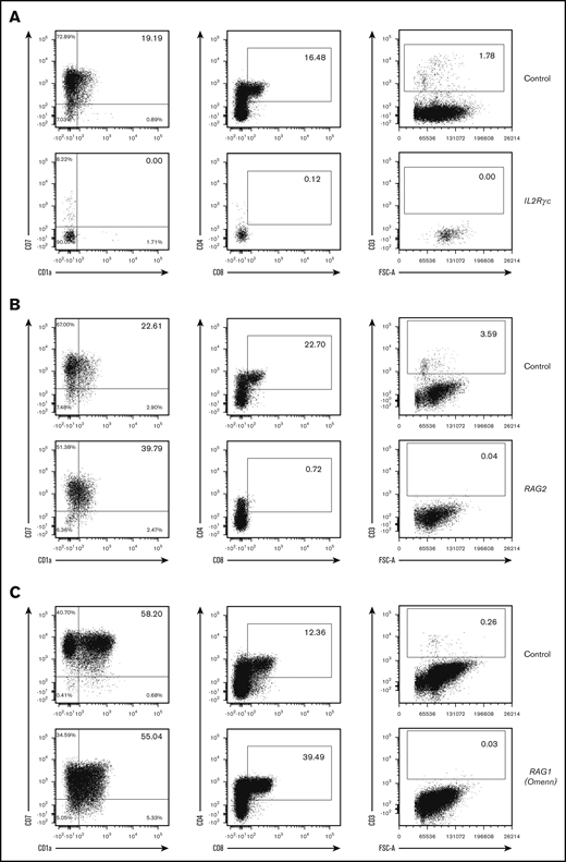 Abnormal in vitro T-cell differentiation of PB-CD34+cells with intrinsic deficiency. (A) A total of 1500 CD34+ cells from PB of an IL2RG/γc SCID patient and a control (cord blood) were differentiated in 3D culture for 3 weeks. (B) A total of 500 CD34+ cells from PB of a RAG (complete deficiency) SCID patient and control (cord blood) were differentiated in 3D culture for 5 weeks. (C) A total of 600 CD34+ cells from PB of a RAG (partial deficiency; Omenn syndrome) SCID patient and control (PB of healthy adult donor) were differentiated in 3D culture for 5 weeks. Displayed events are gated from single cells, negative for 7-AAD and positive for human CD45. Percentages among CD45+7-AAD−CD34−CD19− cells (left column) and CD45+7-AAD− cells (2 right columns) are indicated in inlets. FSC-A, forward scatter area.