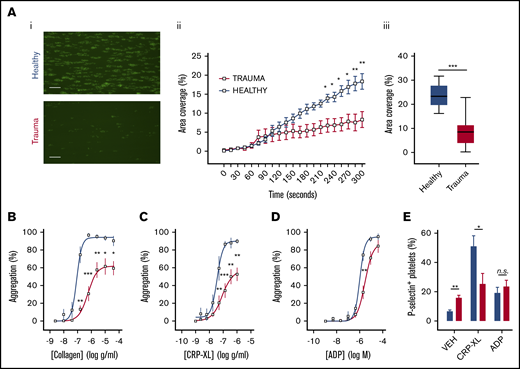 Platelet responsiveness to collagen and GPVI stimulation is reduced in severely injured patients. (A) Platelets from healthy volunteers (n = 10) or trauma patients (n = 14) were labeled with mepacrine (10 μM, green) in whole blood and perfused over collagen at arterial shear rates (1000/s). (i) Representative images after a 5-minute perfusion. Bars represent 25 μm. (ii) Area coverage over time in trauma patients and healthy volunteers. (iii) Area coverage at 5 minutes. (B-D) Platelet aggregometry in PRP from healthy volunteers (blue; n = 10) and trauma patients (red; n = 20) after a 5-minute stimulation with collagen (B), CRP-XL (C) or ADP (D) at 1200 rpm. (E) Platelet P-selectin expression (% positive) measured by flow cytometry after stimulation with CRP-XL (0.1 μg/mL) or ADP (10 μM) for 5 minutes. Two-way ANOVA with Šidák’s multiple-comparisons test (Aii,B-D) or Student t test (Aiii). *P < .05; **P < .01; ***P < .001. n.s., not significant.
