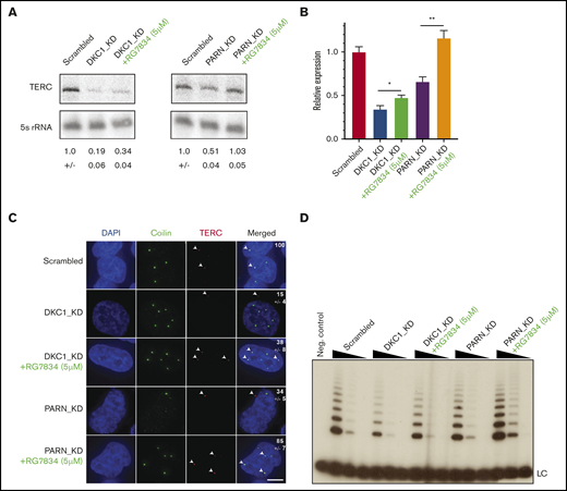 RG7834 treatment rescues TERC levels and localization in DKC1- and PARN-depleted cells. (A) Representative northern blots for TERC levels in HeLa cells under indicated conditions. Numbers below panels: average ± standard deviation for 3 biological replicates. (B) Quantification of TERC by quantitative reverse transcription polymerase chain reaction in HeLa cells under the indicated conditions (n = 3; biological replicates). Values are expressed in relation to scrambled control. (C) Representative images for 4′,6-diamidino-2-phenylindole (DAPI) (nucleus), coilin (cajal body), TERC, and merge of individual channels obtained from HeLa cells transfected with indicated siRNAs and treated with RG7834. White arrows indicate TERC localization within the cell. Scale bar, 5 μm. Numbers in image panels: Quantification of fraction of cells with TERC colocalized to cajal bodies from at least 30 independent cells and 3 replicates. Cells with at least one TERC focus colocalized with coilin were counted. (D) Telomerase activity by telomere repeat amplification in HeLa cells transfected with indicated siRNAs and treated with 5 μM of RG7834 or DMSO. Range of protein concentrations represent fourfold serial dilutions. *P < .05; **P < .01.  LC, loading control.