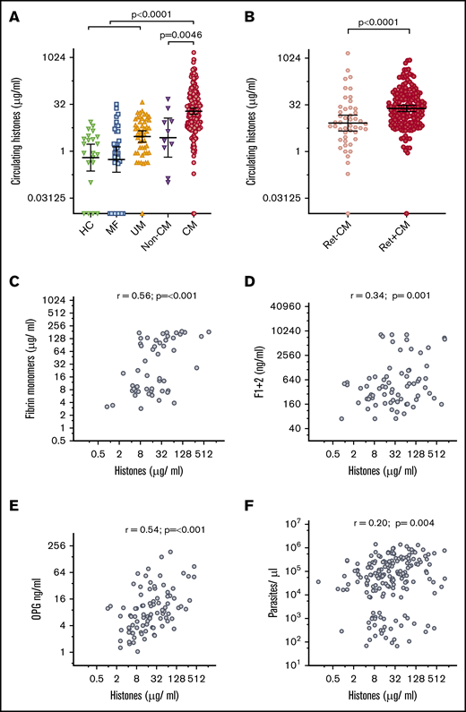 Circulating extracellular histones are elevated in CM. (A) Circulating histone levels measured in the serum of healthy controls (HC; n = 22), and patients with mild febrile illness (MF; n = 34), uncomplicated malaria (UM; n = 50), aparasitemic non-CM coma (Non-CM; n = 10) and admission serum from children who met the standard WHO case definition of CM at presentation (n = 218). Thick black lines and error bars are the geometric mean and 95% CI. (B) Refining the diagnosis of CM by retinal examination, comparison is made between circulating histone levels in children with Ret−CM (n = 48) and Ret+CM (n = 170). (C-F) Scatter plots to examine the correlation between histone levels and plasma factors in children with Ret+CM are shown. (C) Plasma fibrin monomer levels; (D) prothrombin fragment F1+2; (E) OPG; and (F) whole blood peripheral parasite density. (C-E) Data shown were measured by ELISA, and parasite density was calculated from white blood cell–normalized slide counts using thick smears. Comparison was made using ANOVA and Dunnett’s multiple comparison test (A), Student t test (B), and Pearson's correlation coefficient (C-F). Non-CM are aparasitemic children with encephalopathy in a coma due to a cause other than malaria.