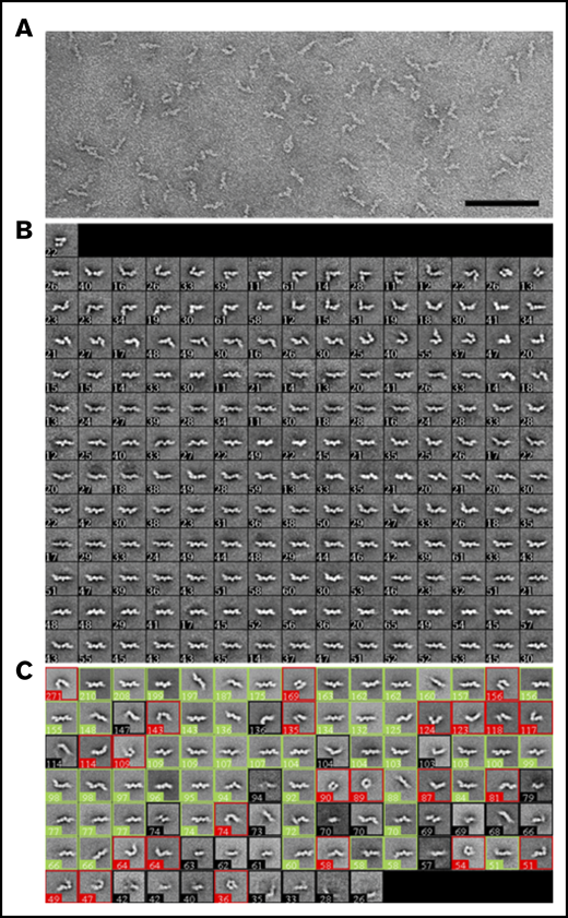 Analysis of D-dimer by negative-stain EM. (A) A typical image area of negatively stained D-dimer. The bar represents 100 nm. (B) The 181 class averages obtained with the ISAC algorithm.43 (C) The 100 class averages obtained by k-means classification shown from the most populous class on the top left to the least populous class at the bottom right. Averages were assigned to show D-dimers in a straight conformation (green boxes) or in a bent conformation (red boxes) or were not assigned if the features were ambiguous (black boxes). The numbers in the lower left corner of each average in panels B and C indicate the number of particles in the class; the side length of the individual averages is 42.4 nm.