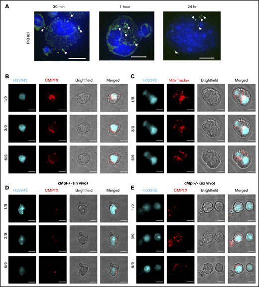 PEVs interact with BM MKs in vitro and in vivo. Human platelets were labeled with either PKH67 (membrane marker), CMPTX (cytosol stain), or MitoTracker Red (mitochondrial marker) and activated with thrombin (0.1U/mL) and collagen (1 μg/mL) to generate PEVs. (A) PKH67-labeled PEVs were incubated with murine BM-derived MKs and fixed over a time course of 30 minutes, 1 hour, and 24 hours. Cells were then harvested and stained with Hoechst (H33342) before confocal microscopy analysis. Representative images are z-stack maximum projections. (B) CMPTX-labeled and (C) MitoTracker–labeled PEVs were incubated with isolated, cultured MKs for 24 hours. Cells were then fixed, permeabilized, stained with Hoechst, and examined by confocal microscopy. The images were taken at different confocal planes with 5 µm z-stack steps. The numbers represent a specific slice (z stack) number/total number of slices. (D) Wild-type (MPL+), CMPTX-labeled platelets were infused into cMpl−/− mice before an LPS injection, as in Figure 1. Mice were euthanized after 20 hours, BM was flushed, incubated with anti-CD41 Ab, and sorted for CMPTX+/CD41+ BM cells by flow cytometry. Sorted populations were fixed, stained with Hoechst, and imaged by confocal microscopy. (E) Wild-type (MPL+), CMPTX-labeled PEVs were cultured with freshly isolated cMpl−/− BM over 72 hours. Cultures were then stained with anti-CD41 and sorted for CMPTX+/CD41+ cells. Sorted populations were fixed, stained with Hoechst, and imaged by confocal microscopy. Scale bars, 10 µm.