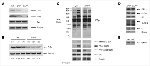 Protein expression and tyrosine phosphorylation in control and GP6homplatelets. (A) Western blot showing levels of GPVI, FcRγ, Syk, and tubulin (loading control) in control, GP6het, and GP6hom individuals. (B) Densitometry reading of the level of FcRγ and tubulin (loading control) in a GP6hom individual relative to a control (the GP6hom individual is not related to the donor in panel A). (C) Collagen (30 μg/mL) stimulation of tyrosine phosphorylation in a control and GP6hom individual (90-second stimulation). (D) Western blot of representative proteins from GP6het and GP6hom donors. (E) Western blot of GPIIb from control and GP6hom donors. Results are representative of 3 (A-C) or 4 (D-E) unrelated GP6hom individuals. Mwt, molecular weight; WT, wild type.