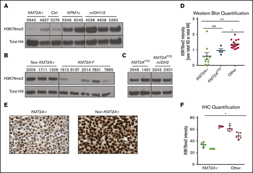 KMT2A-r AML has significantly lower levels of H3K79me2. (A) Western blot analysis for H3K79me2 in a cohort of AML patient samples from the University of Pennsylvania (A), the University of Colorado (B), and the Cancer Genome Atlas (C). See supplemental Table 1 for additional details about all patient samples. (D) Quantification of H3K79me2 levels in all patients’ western blots compared with total H3 or total H4 (Figures 1A, 6G-H). *P < .01, **P < .001; Student t test. (E) H3K79me2 immunohistochemistry of representative patient samples with and without a KMT2A-r. (F) Quantification of H3K79me2 immunohistochemistry staining. Four to 6 individual areas were analyzed for each slide. Average intensity of H3K79me2 over all areas is shown for each patient. KMT2A-r samples (n = 2), non–KMT2A-r samples (n = 3). *P < .05; Student t test.