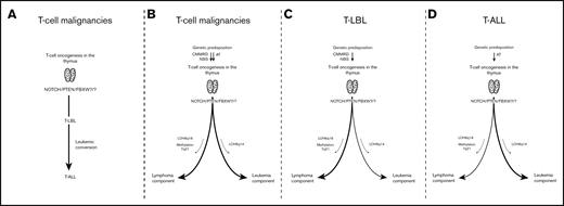 Hypothesis on the pathogenic origin and acquisition of mutations that result in T-LBL or T-ALL. (A) Hypothesis in which T-ALL emerges from a preexisting T-LBL clone. (B-D) Alternative hypothesis in which T-LBL and T-ALL share a common pathogenic origin but require additional and unique mutations.