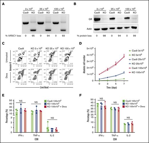 Successful scale-up of CRISPR-Cas9–mediated NR3C1 deletion in VSTs. (A) Different VST numbers (3 × 106, 25 × 106, and 100 × 106) were electroporated in the presence of Cas9 and gRNA using the Lonza 4D nucleofector and the NR3C1 KO efficiency in Cas9 (control) or NR3C1 KO VSTs was determined using PCR (A; n = 3) and western blot analysis (B; n = 3). β-actin was used as loading control in panel B. The percentages (%) of NR3C1 KO efficiency (A) and GR protein loss (B) after CRISPR-Cas9 gene editing are shown under each figure. (C) Representative FACS plots showing the percentage of apoptotic cells (annexin V+) and alive or dead cells (live/dead stain) in control Cas9 and NR3C1 KO VST cells at the different cell dose levels of 3 × 106, 25 × 106, or 100 × 106 cells per electroporation treated with or without Dexa (200 μM) for 72 hours (n = 3). (D) Graph summarizing the absolute cell number between control Cas9 (solid lines) and NR3C1 KO VST cells (dotted lines) at the different cell dose levels of 3 × 106 (green), 25 × 106 (blue), or 100 × 106 (red) cells per electroporation for 72 hours (n = 3). Bars represent mean values with SD. (E-F) Bar graphs showing the percentage of IFN-γ, TNF-α, or IL-2 production by 100 × 106 control Cas9 (green), 100 × 106NR3C1 KO (blue), or 100 × 106NR3C1 KO plus dexamethasone (Dexa 200 μM; red) VSTs in response to 6-hour stimulation with the relevant viral PepMix in the CD8+ T-cell (E) and CD4+ T-cell (F) compartments (n = 3). The functional analysis of the Cas9+Dexa group was not performed due to the absence of viable cells resulting from the lymphocytotoxic effect of steroids. The bars represent mean values with SD.