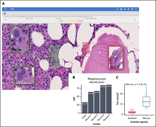 Efficiency of the assisted tool for megakaryocyte identification. Our Web-based interface for assisted annotation. (A) Candidate megakaryocytes are automatically identified by the AI algorithm, allowing hematopathologists to quickly review and confirm these as megakaryocytes (green boxes) or nonmegakaryocytes (red boxes). The human-in-the-loop assisted annotation achieved a high level of accuracy as measured by the mean average precision (mAP) within a few training iterations (B), and the annotation time was significantly reduced (C) (Wilcoxon rank-sum test, significance level 0.05).
