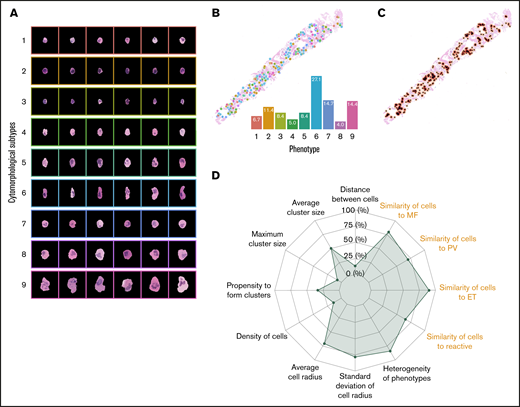 Abstract representation of BMT samples. (A) A total of 9 megakaryocytic phenotypes were automatically discovered in the unsupervised clustering analysis. Morphological representation characterized by proportions and heterogeneity of the megakaryocytic phenotypes (B) and topographical distribution (C) can be used to describe a BMT sample in the form of a radar plot (D). In total, we analyzed 17 features, 9 of which were related to the proportions of the megakaryocyte phenotypes and visualized in the form of morphological similarities to megakaryocytes in different subgroups of MPNs or reactive cases (highlighted in orange on the radar plot).
